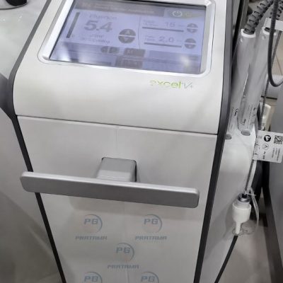 Cutera Excel V+ Laser Treatment